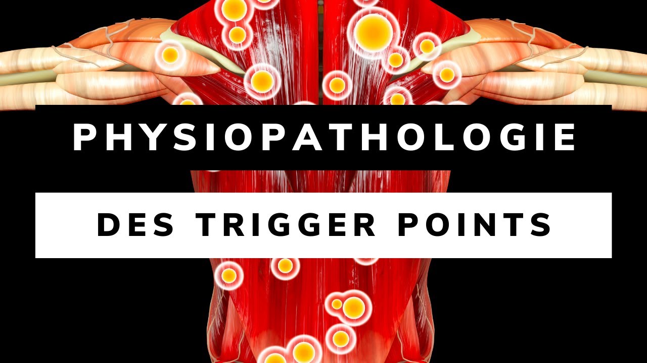 PHYSIOPATHOLOGIE et ETIOLOGIE DES TRIGGERS POINTS