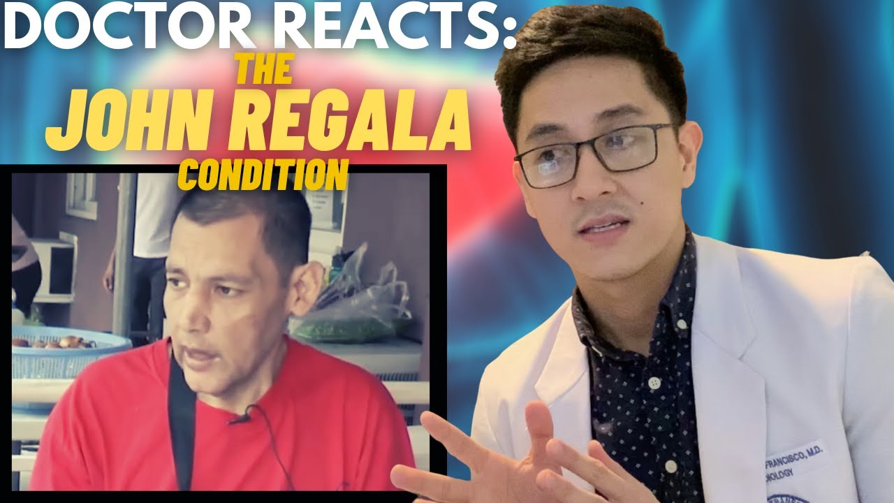 LIVER CIRRHOSIS: JOHN REGALA HEALTH CONDITION (EXPLAINED)