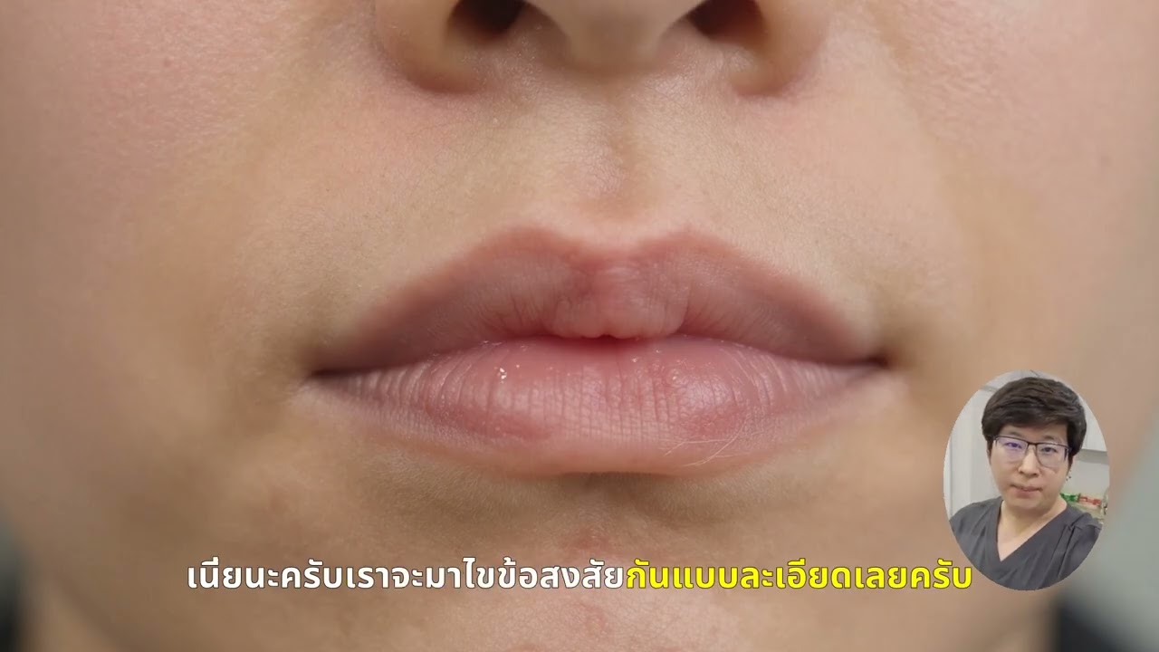 เลเซอร์รักแร้ขาว: บอกลาใต้วงแขนหมองคล้ำ