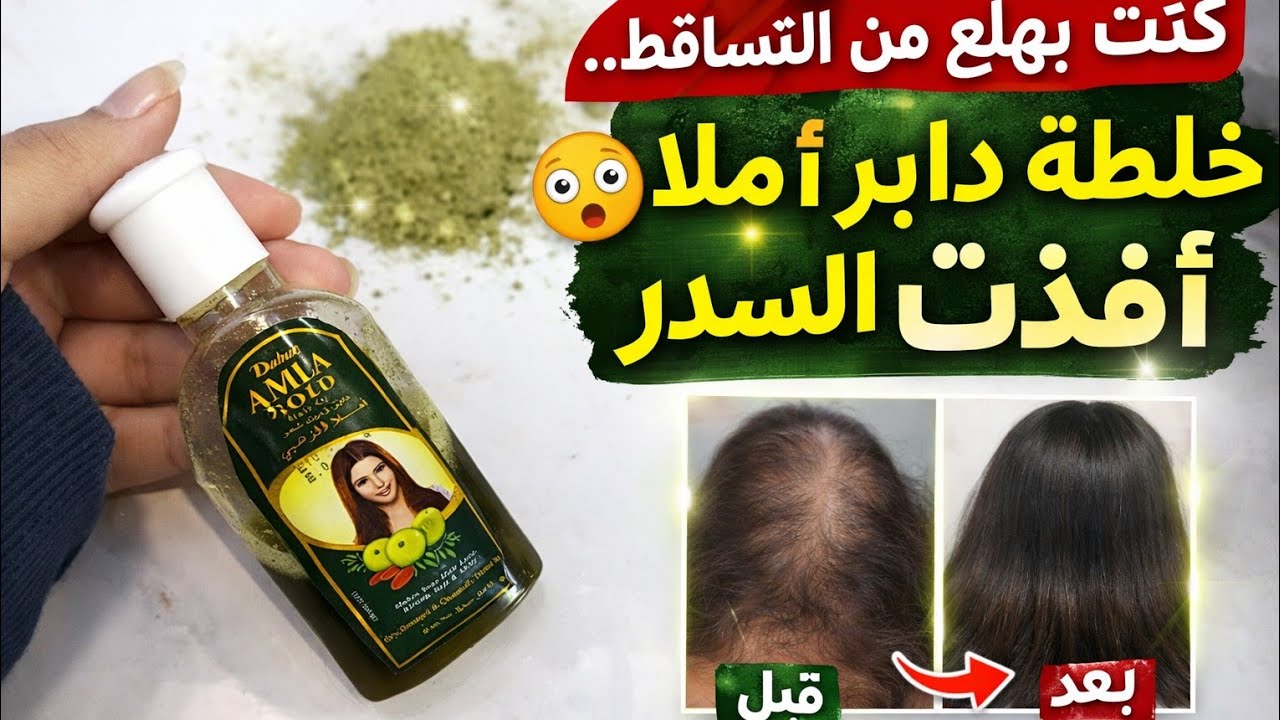 شعري كان بيختفي… ومع دابر أملا + السدر رجع أقوى من الأول 
