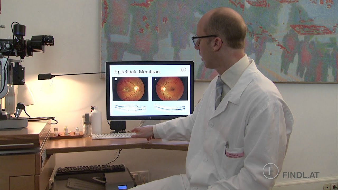 Epiretinale Membran - Macular Pucker, Prof. Findl, Wien