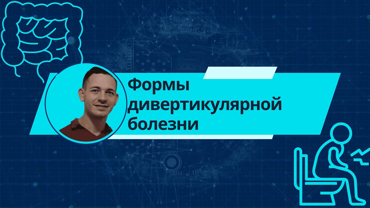 Формы дивертикулярной болезни