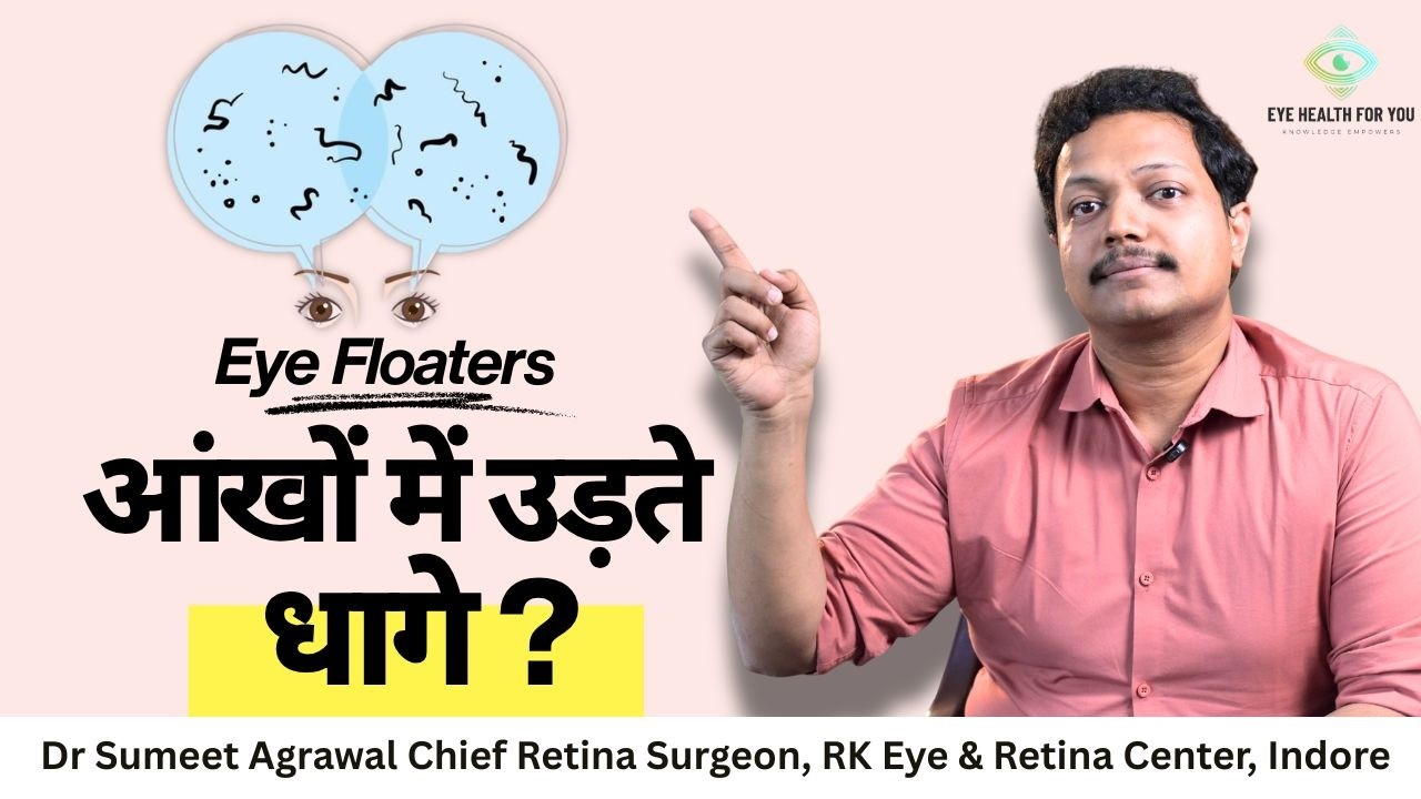 Eye Floaters क्या होते हैं? आंखों में उड़ते धागे या धब्बे क्यों दिखते हैं | Dr Sumeet Agrawal
