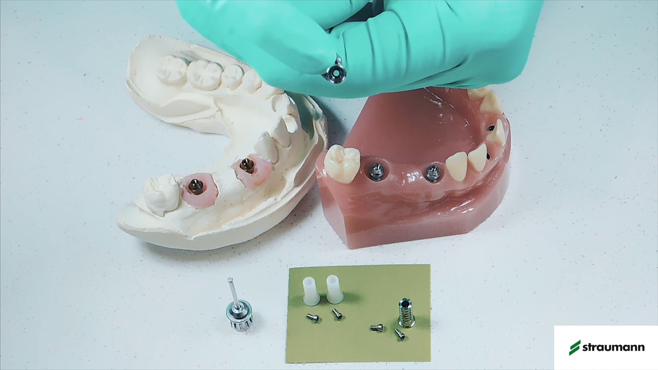 Prótesis atornillada unitaria o múltiple en implantes Bone Level Sistema Straumann SRA