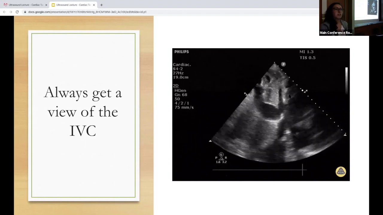 Dr Belyavskaya   Ultrasound: Cardiac Tamponade and Pericardiocentesis