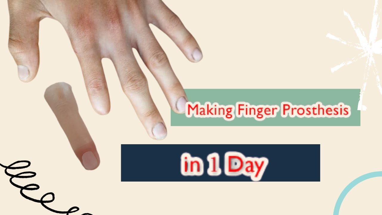 making Finger prosthesis | index finger lost | prosthesis | Custom finger prosthesis