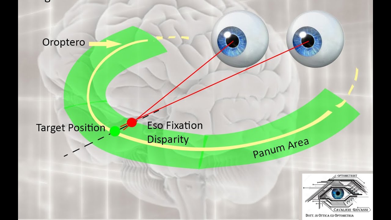 What is Fixation Disparity [ Sub - ENG ] - Fixation Disparity part1