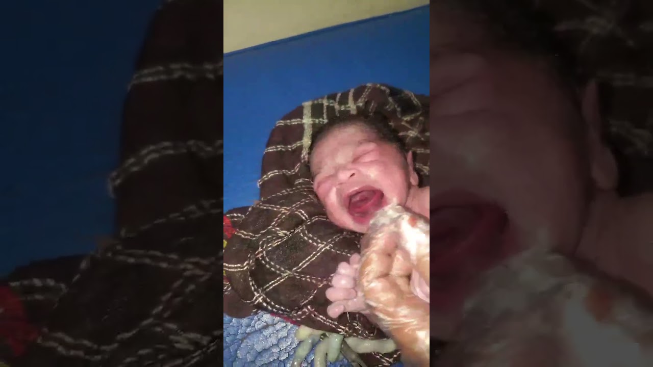 Hello Mom!Your 1st Baby Here With long Umbilical Cord and With Thick Vernix
