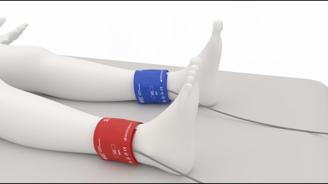 AngE™ ABI+ – Vascular Screening Test