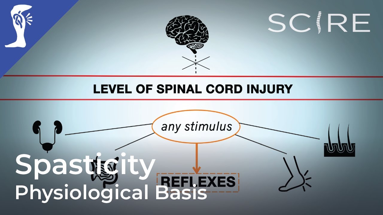 Spasticity and Spinal Cord Injury: Physiological Basis