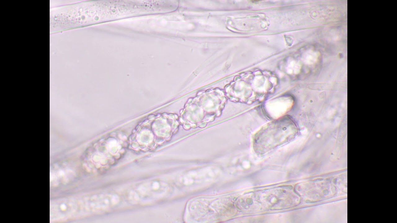 Trichophaea paludosa - ascospores in H20