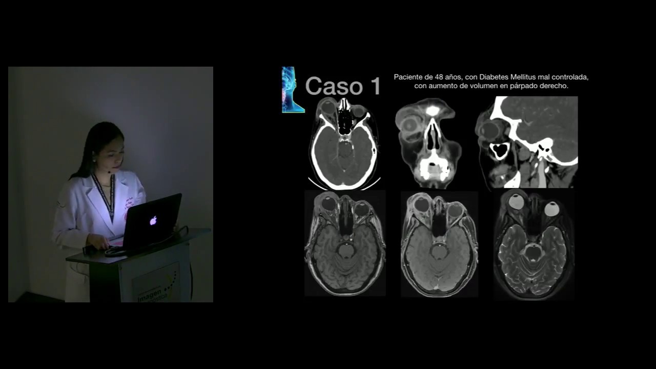 Emergencias en cabeza y cuello. Dra. Karla Jonguitud.