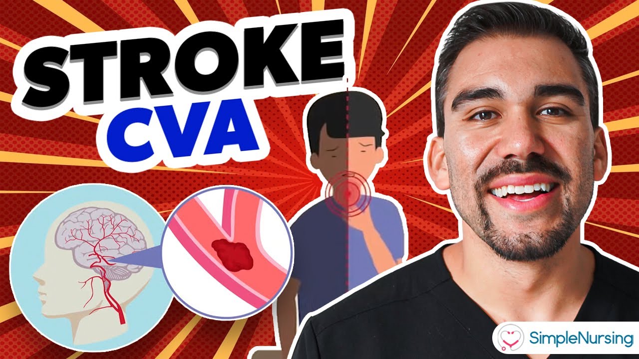 Short Stroke CVA Video