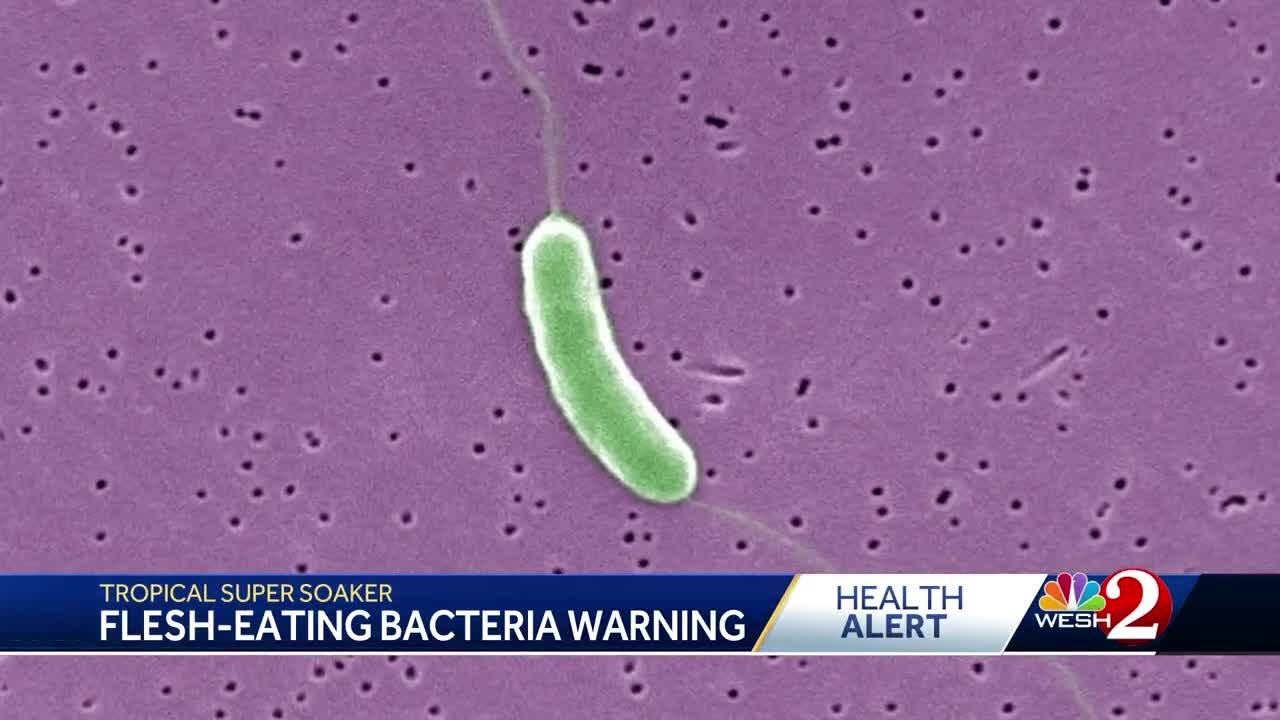 Flesh-eating bacteria kills four people in the state of Florida