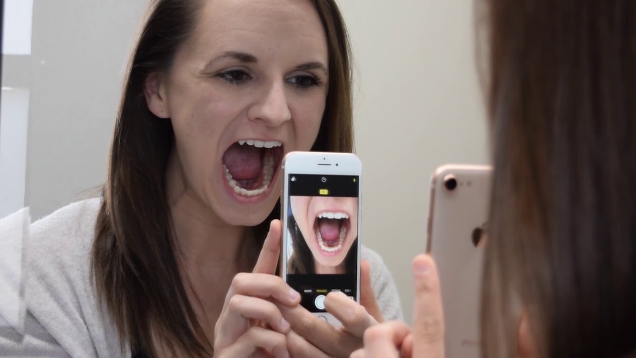The Patient Guide To Taking Great Photos For Your Dentist