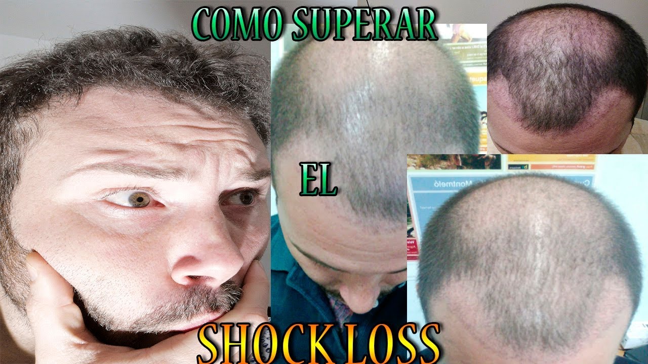 COMO SUPERAR EL SHOCK LOSS