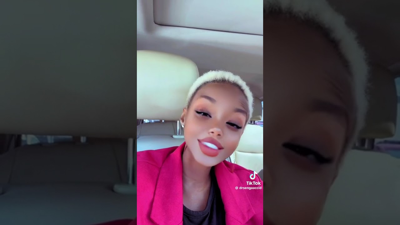 Ssenga acid ku nsonga za nkoko nkoko ne kitaawe 