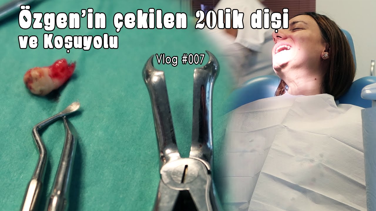 Özgen'in çekilen 20lik dişi ve koşuyolu | Vlog 007