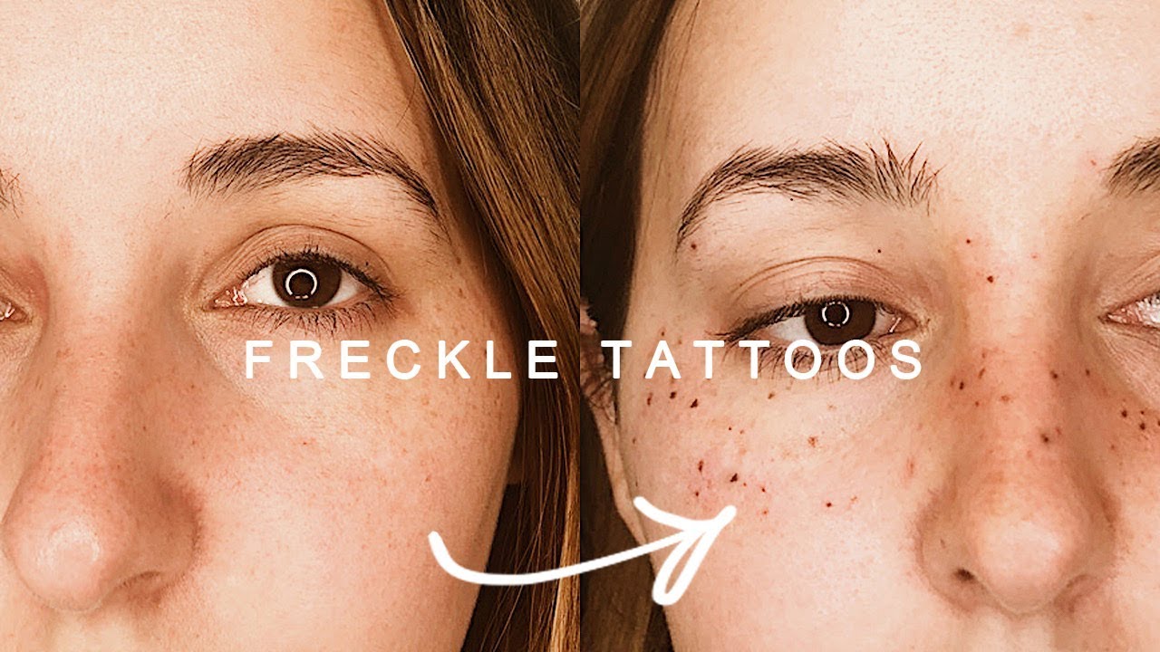 I GOT FRECKLE TATTOOS * COST? DID IT HURT?
