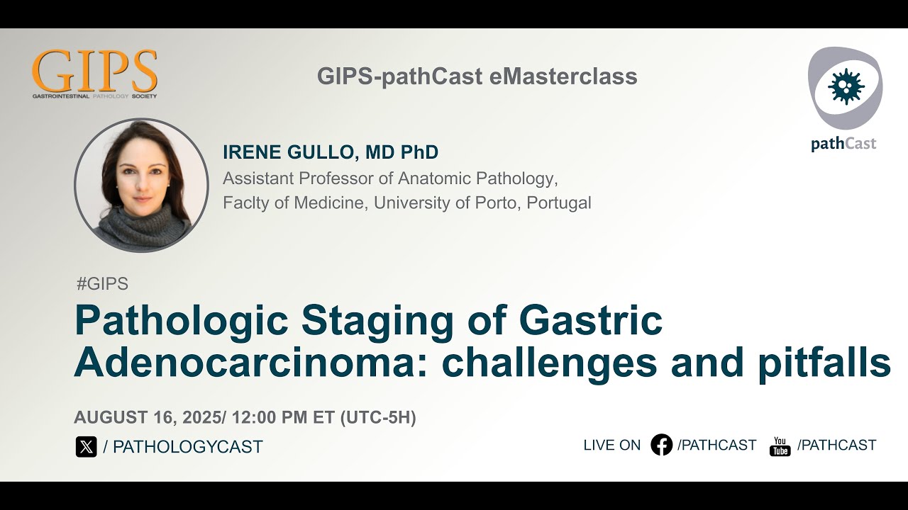 #GIPS Pathologic Staging of Gastric Adenocarcinoma: challenges and pitfalls