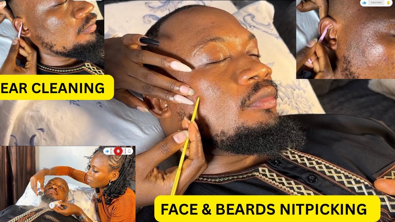 ASMR Attentive ingrown hair pulling from beard,full face nitpicking,face and ear massage,GOOD SLEEP
