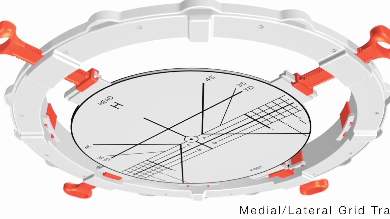 #1 Thing All Direct Anterior Surgeons Should Know!