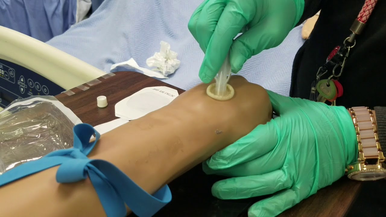 How to start an IV