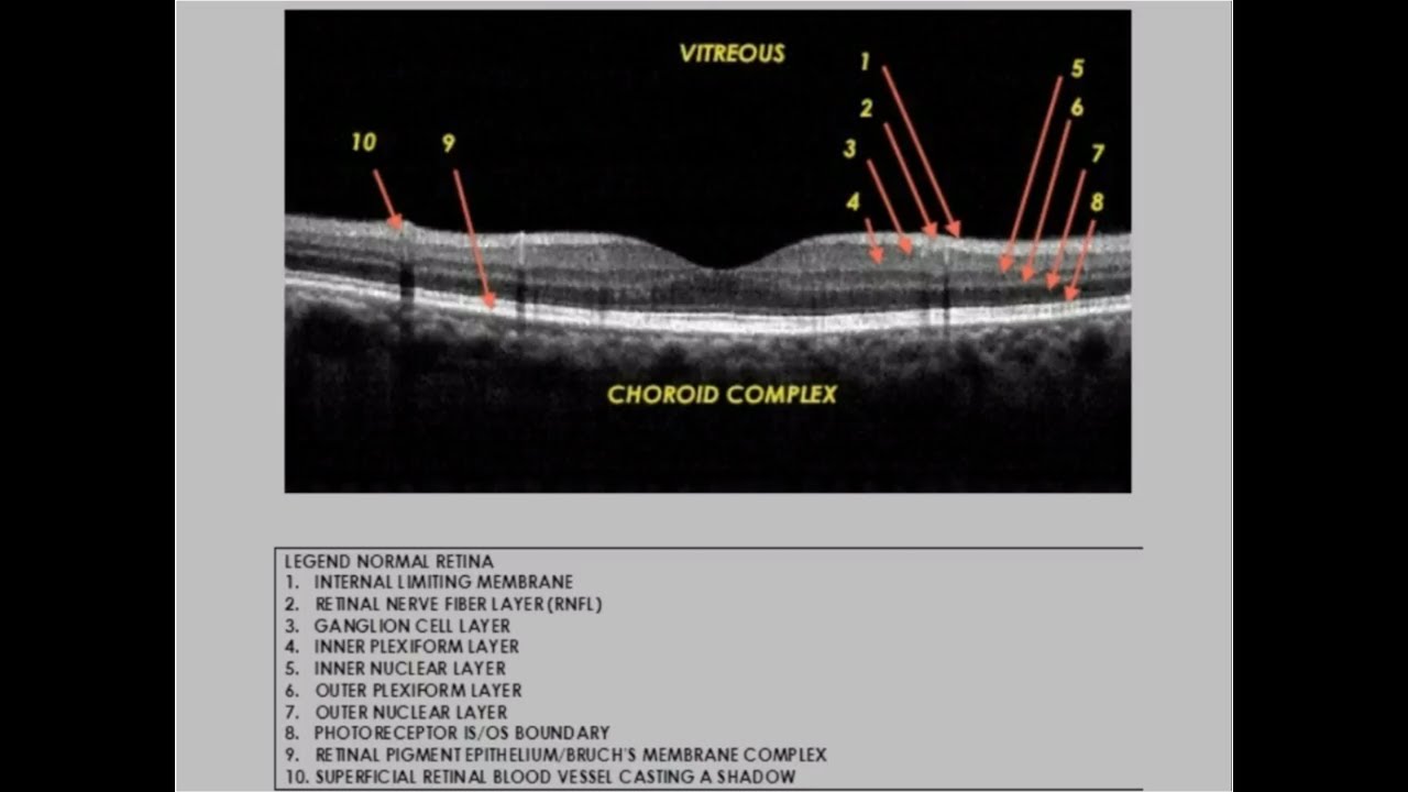 OCT  Not Just for Specialty Clinics Anymore with Dr  Mile Brujic