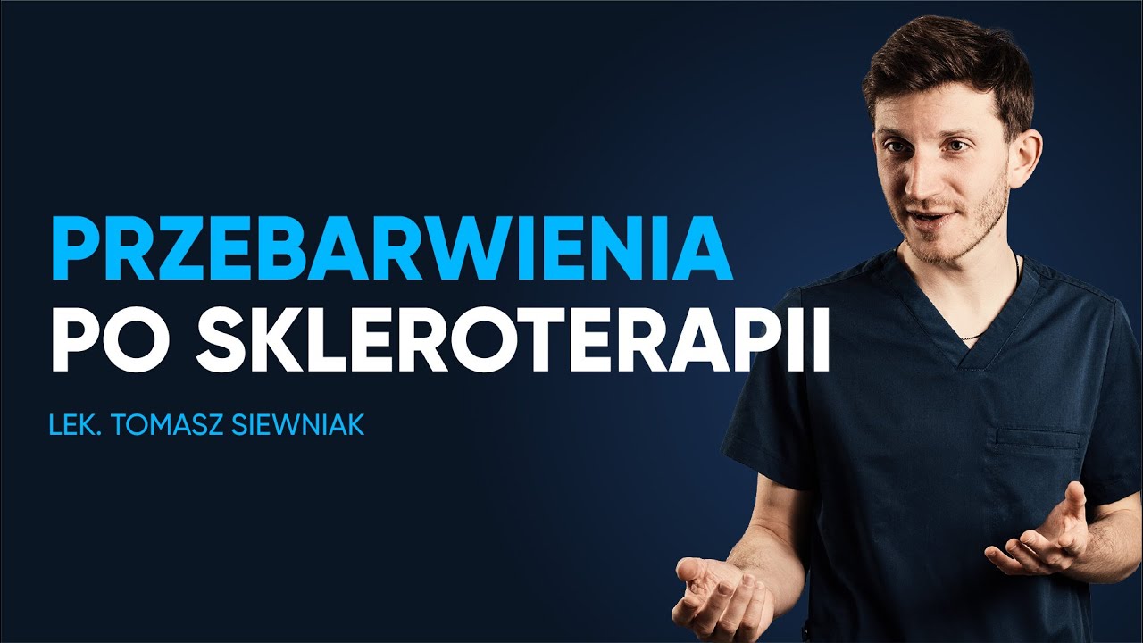 Jak pozbyć się przebarwień po skleroterapii?