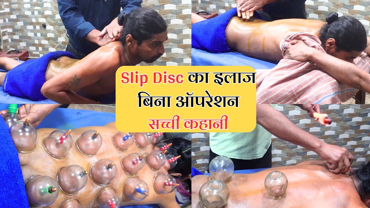 ✅ L4-L5 Slip Disc के Operation से बचाया | कमर दर्द का पूरा ईलाज | आयुर्वेदिक पंचकर्म विधियों से