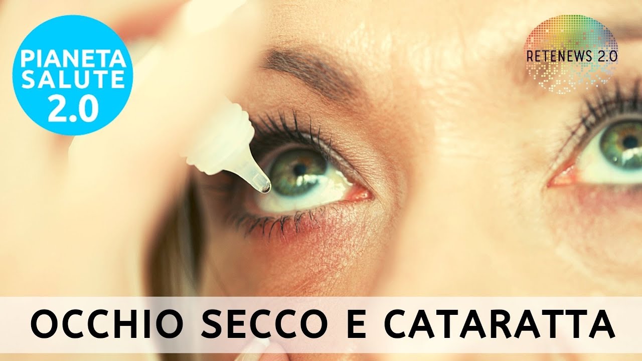 Occhio Secco e Cataratta: Approfondimenti e Soluzioni Innovative