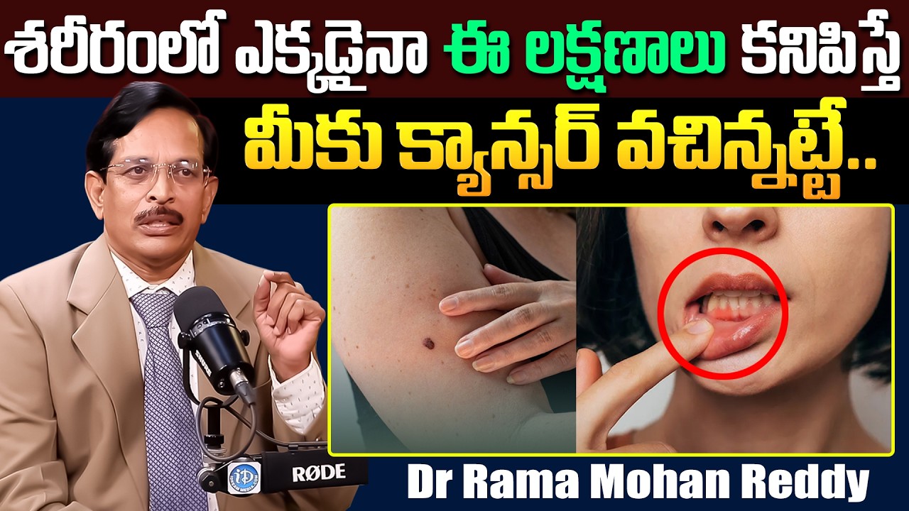 Dr Rama Mohan Reddy - మీకు ఈ లక్షణాలు కనిపిస్తే క్యాన్సర్ వచిన్నట్టే.. | Cancer Symptoms | iDream