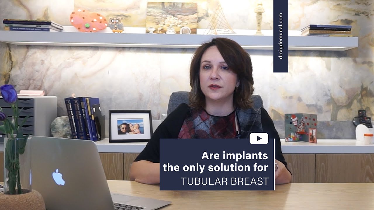 Are Implants The Only Solution For Tubular Breast