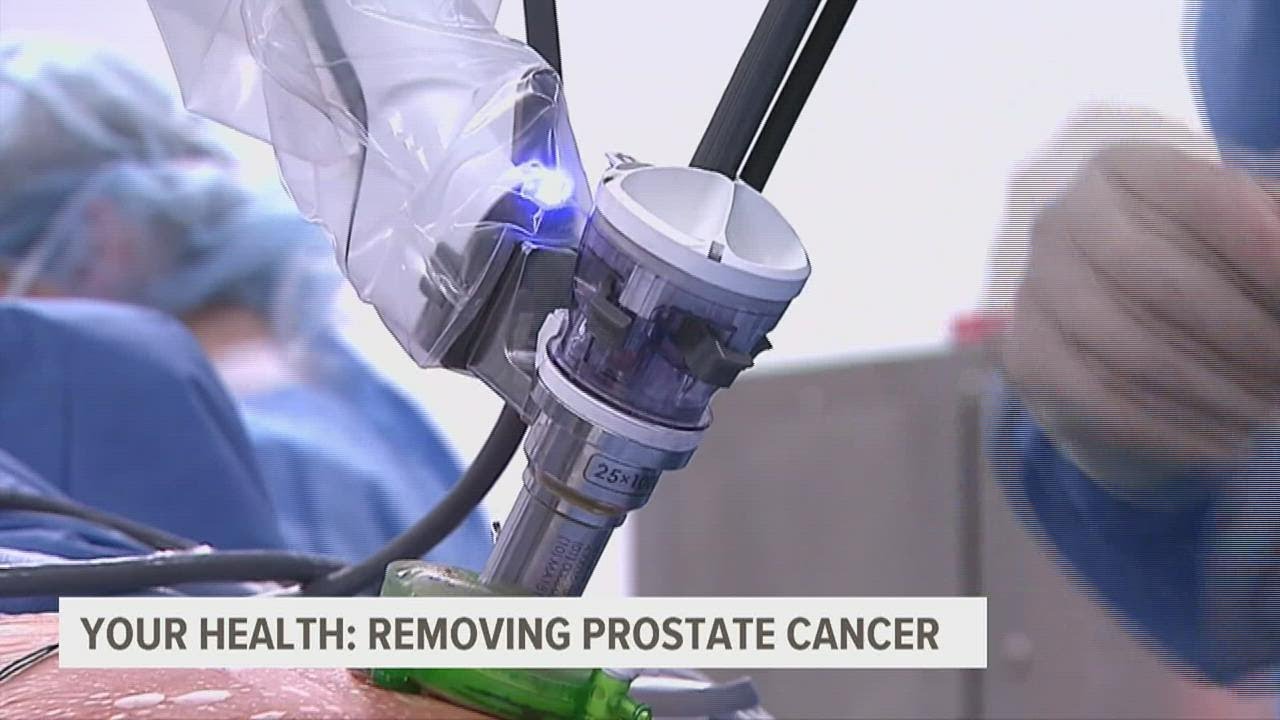 First-of-its-kind prostate cancer surgery goes through the bladder