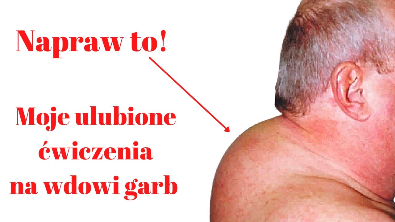 Najlepsze ćwiczenia na wdowi garb. Wykonaj w 5 minut. Rehabilitacja domowa.