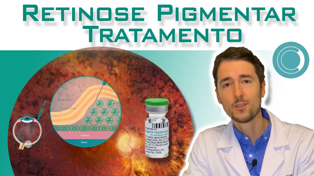 Retinose Pigmentar - tratamento com terapia gênica