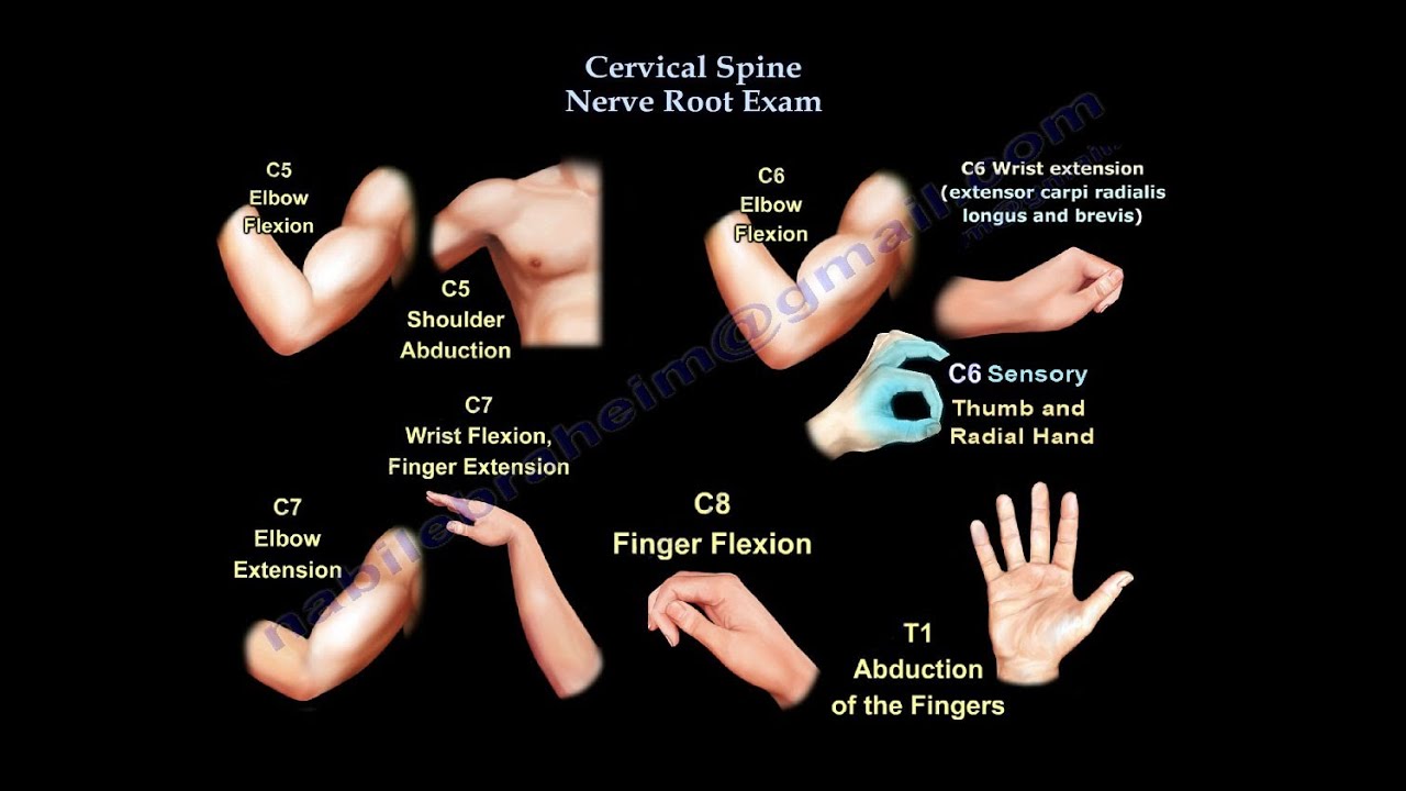 Cervical Spine Nerve Root Exam - Everything You Need To Know - Dr. Nabil Ebraheim