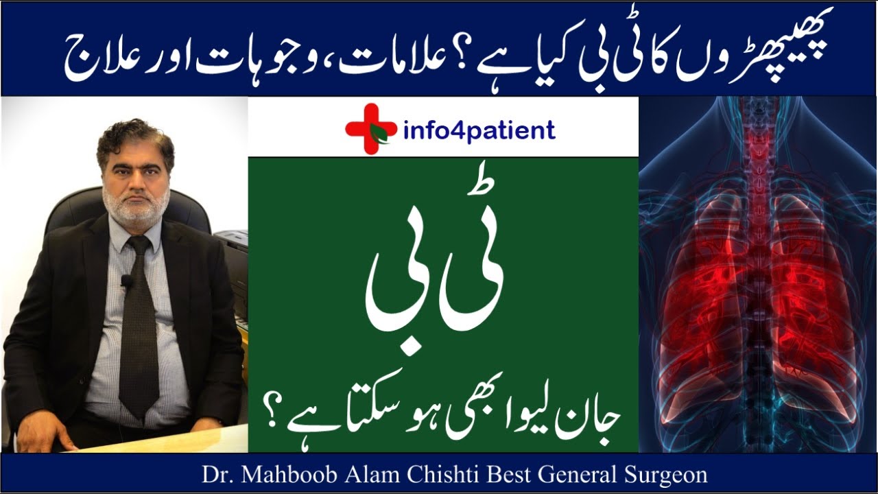 ٹی بی کب خطرناک ہوتا ہے؟ | TB Symptoms & Treatment | Dr. Mahboob Alam Chishti