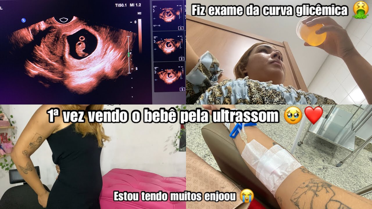 1ª VEZ VENDO O BEBÊ PELA ULTRASSOM| FIZ EXAME D CURVA GLICEMICA| ESTOU MUITO MAL NESSA GRAVIDEZ🤮