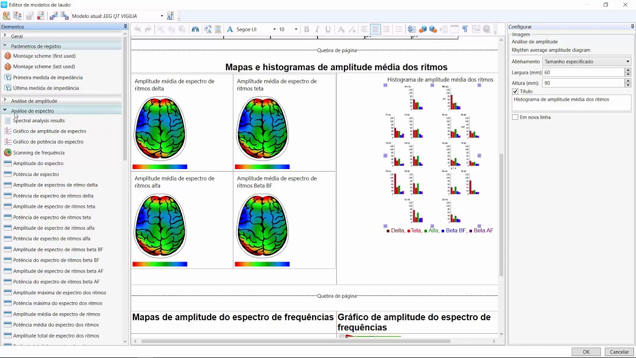 laudo eeg quantitativo