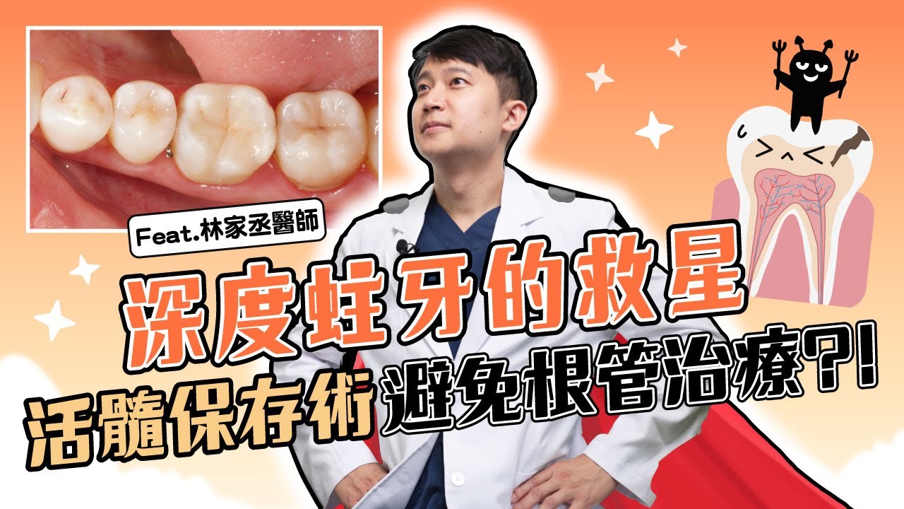 深度蛀牙的救星！活髓保存術與微創齒雕給牙齒根管治療（抽神經）前多一次的機會  Ft.林家丞醫師【品悅牙醫】