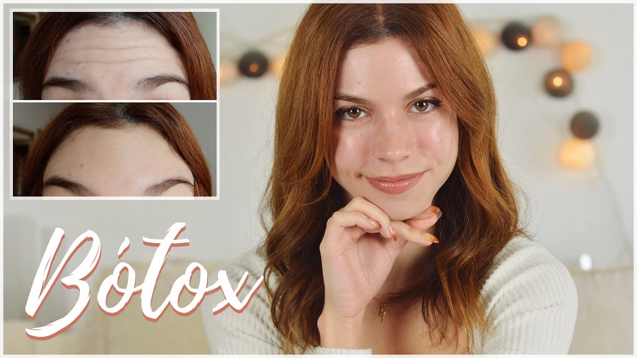 BÓTOX | Principales dudas + mi experiencia (con la Dra. Pinilla)