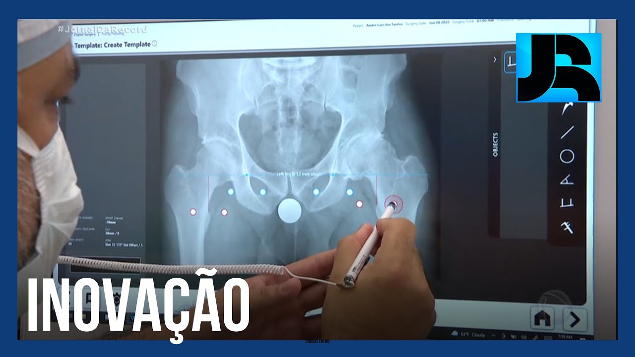 Hospital de São Paulo usa tecnologia inovadora em cirurgias de prótese de quadril