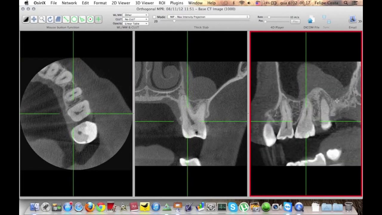 Tutorial Básico OsiriX / Horos