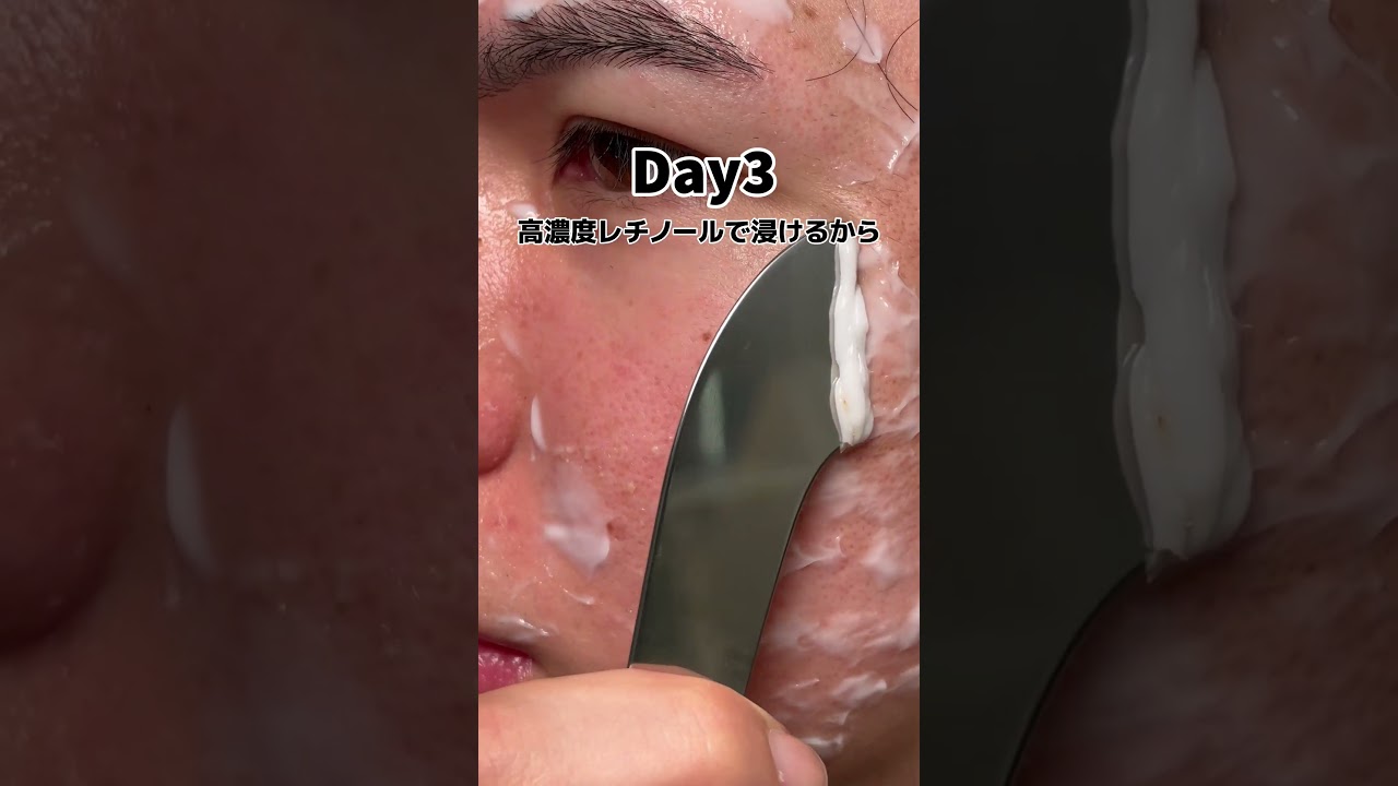 君は手が温かい？？KITENレチノールクリームの詳細はプロフリンクから！ #PR #KITENレチノールクリーム #3分動画 #スキンケア #レビュー
