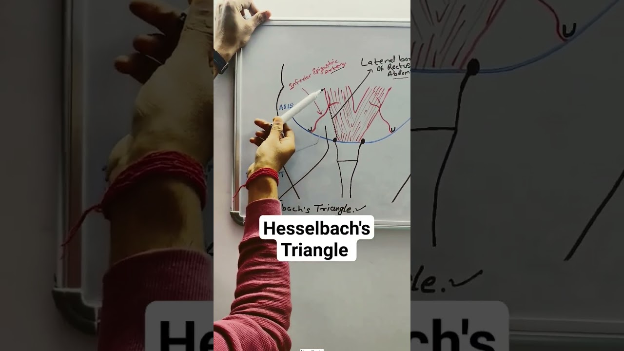 Hesselbach's Triangle | Hernia #learning #bams #mbbs #shorts