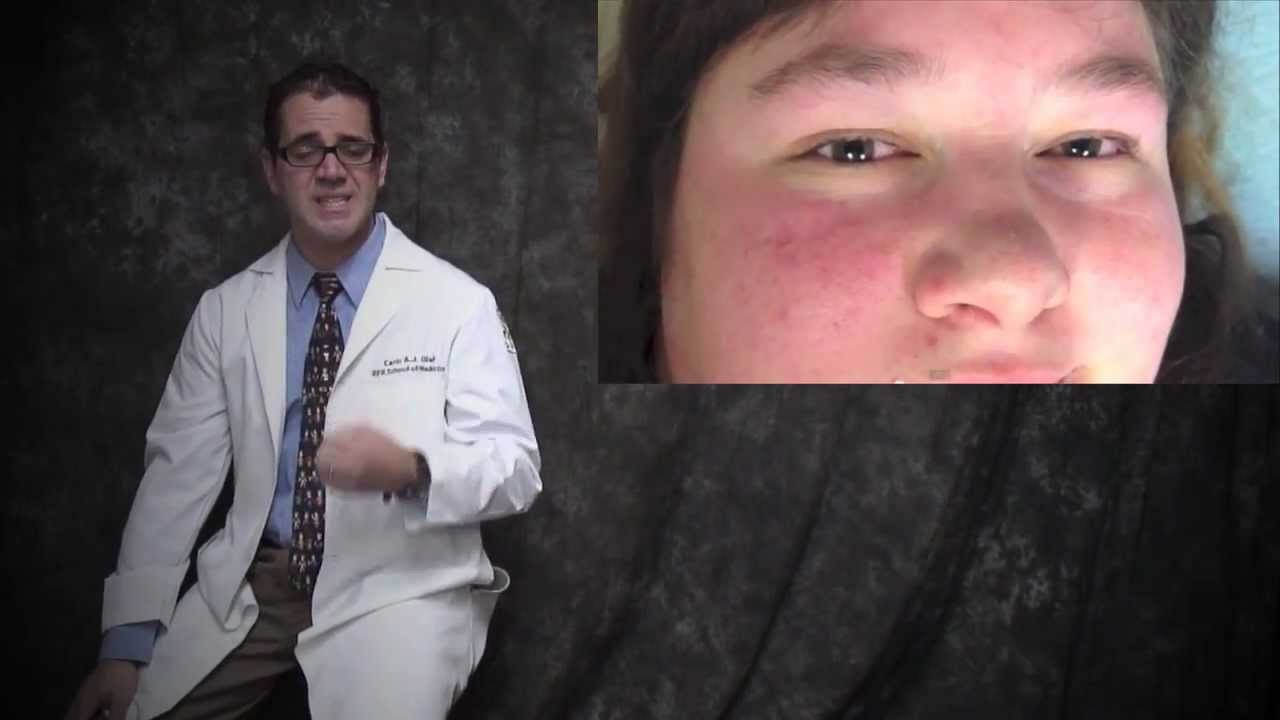 nystagmus v2 (FULL VIDEO)