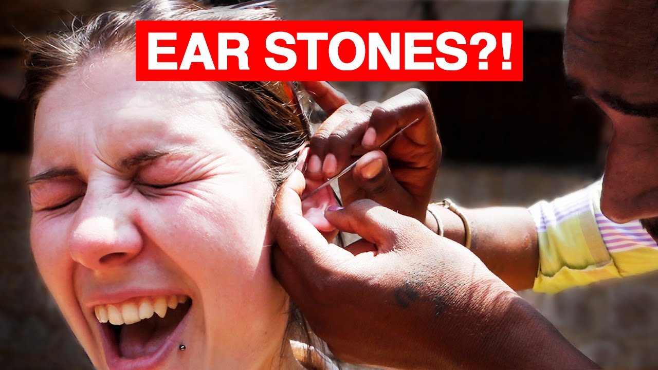 Indian Ear Cleaning | STONES?!