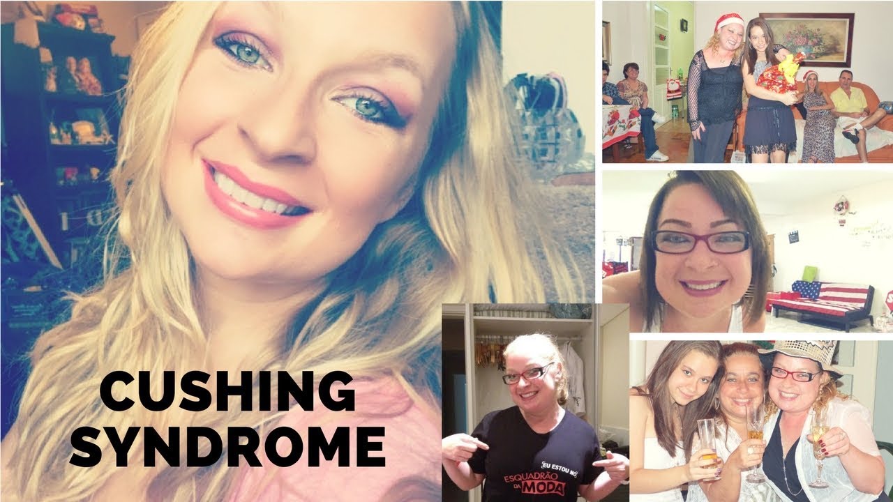 Cushing Syndrome
