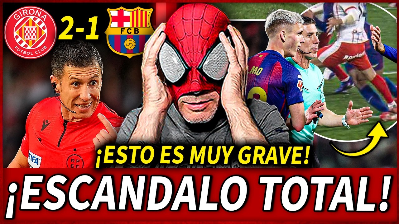 ¡BOCHORNO!😱¡SE REVELA el MOTIVO del POR QUÉ el VAR NO REVISÓ la FALTA a KOUNDÉ!